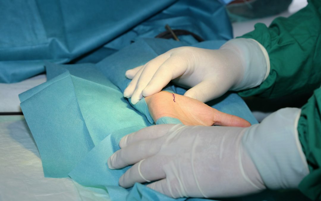 Descubren una relación entre las cirugías de descompresión nerviosa y la migraña