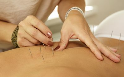 ¿Cuán efectiva es la acupuntura en el tratamiento de la cefalea tensional crónica?