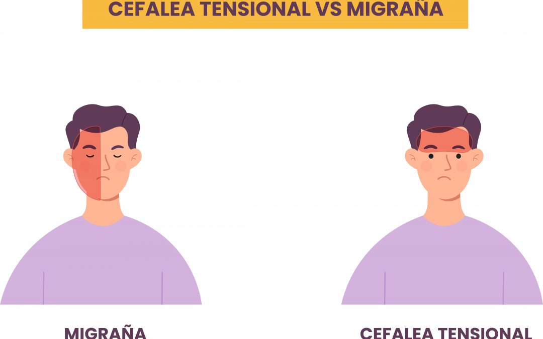 Cómo diferenciar una cefalea tensional de una migraña