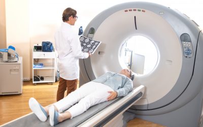Nueva recomendación para las pruebas de imagen en pacientes con cefalea